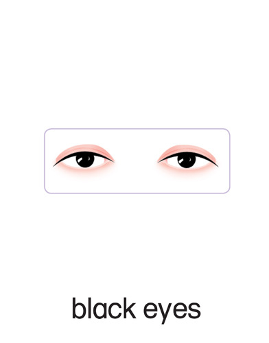 151 black eyes